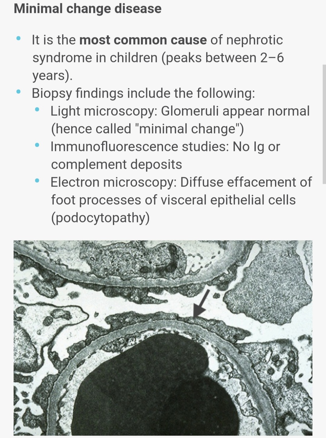 minimal-change-disease-medicine-notes-teachmint