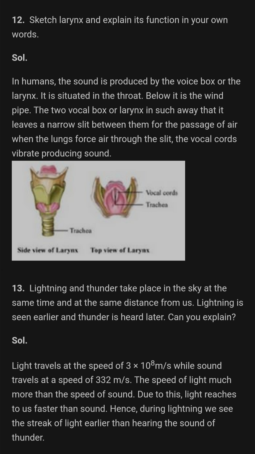 Sketch larynx and explain its function in your own words  Brainlyin
